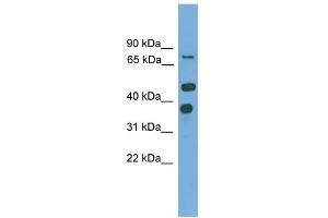 WB Suggested Anti-PTPN11 Antibody Titration: 0. (PTPN11 antibody  (N-Term))