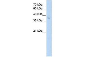 Human MCF7; WB Suggested Anti-SPDEF Antibody Titration: 2. (SPDEF/PSE antibody  (N-Term))