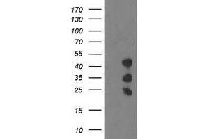 Western Blotting (WB) image for anti-PDZ and LIM Domain 2 (PDLIM2) antibody (ABIN1500129) (PDLIM2 antibody)