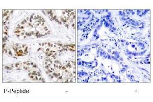 Image no. 2 for anti-V-Rel Reticuloendotheliosis Viral Oncogene Homolog B (RELB) (pSer552) antibody (ABIN197016)