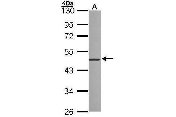 ZNF277 antibody