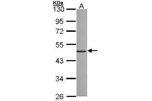 WB Image Sample (30 ug of whole cell lysate) A: 293T 10% SDS PAGE antibody diluted at 1:1000 (ZNF277 antibody)