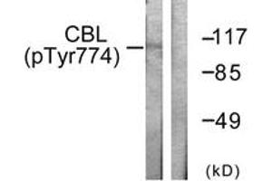 Western blot analysis of extracts from HeLa cells treated with EGF 200ng/ml 30', using CBL (Phospho-Tyr774) Antibody. (CBL antibody  (pTyr774))