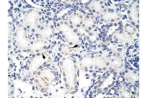 SNRPA1 antibody was used for immunohistochemistry at a concentration of 4-8 ug/ml to stain Epithelial cells of renal tubule (arrows) in Human Kidney. (SNRPA1 antibody  (C-Term))
