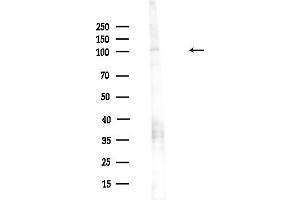 anti-NOP2/Sun Domain Family, Member 2 (NSUN2) (Internal Region) antibody