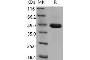 Western Blotting (WB) image for Carboxypeptidase B1 (Tissue) (CPB1) (Active) protein (His tag) (ABIN7194606) (CPB1 Protein (His tag))