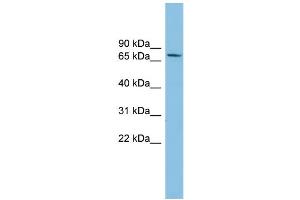 WB Suggested Anti-SENP2 Antibody Titration: 0. (SENP2 antibody  (Middle Region))