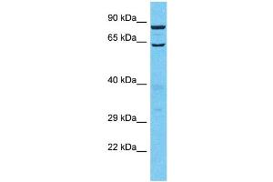Western Blotting (WB) image for anti-Tubulin Tyrosine Ligase-Like Family, Member 13 (TTLL13) (C-Term) antibody (ABIN2791971) (TTLL13 antibody  (C-Term))