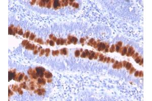 Formalin-fixed, paraffin-embedded human colon stained with CD95 Mouse Monoclonal Antibody (FAS/3112). (FAS antibody  (AA 26-96))