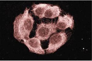 Immunofluorescence staining of A431 cells (Human epithelial carcinoma, ATCC CRL-1555). (PTPN11 antibody  (AA 1-177))