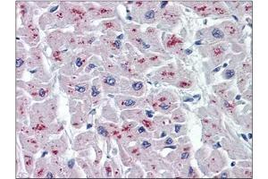 Immunohistochemistry (IHC) image for anti-N-Acylsphingosine Amidohydrolase (Acid Ceramidase) 1 (ASAH1) (AA 25-125) antibody (ABIN782337) (ASAH1 antibody  (AA 25-125))