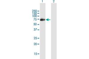 Western Blot analysis of PIAS1 expression in transfected 293T cell line by PIAS1 MaxPab polyclonal antibody. (PIAS1 antibody  (AA 1-651))