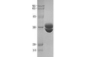 Validation with Western Blot (F11R Protein)