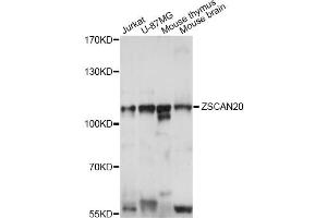 Western blot analysis of extracts of various cell lines, using ZSCAN20 antibody (ABIN6291081) at 1:1000 dilution. (ZSCAN20 antibody)