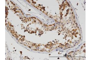 Immunoperoxidase of monoclonal antibody to ZBP1 on formalin-fixed paraffin-embedded human testis. (ZBP1 antibody  (AA 2-100))