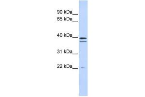 RABGGTB antibody used at 1 ug/ml to detect target protein. (RABGGTB antibody  (Middle Region))