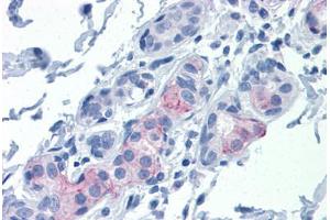 Human Breast: Formalin-Fixed, Paraffin-Embedded (FFPE) (Claudin 1 antibody  (AA 1-212))