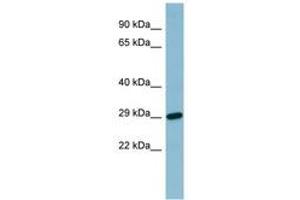 Image no. 1 for anti-Retinol Binding Protein 4, Plasma (RBP4) (N-Term) antibody (ABIN6741649)