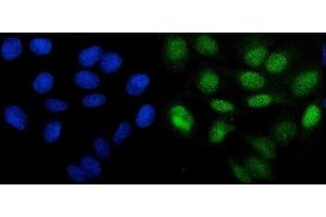 IF analysis of PHF21B using anti-PHF21B antibody (ABIN7601150). (PHF21B antibody  (AA 291-499))