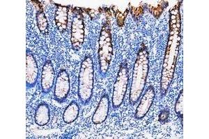 IHC analysis of Cytokeratin 20/Krt20 using anti-Cytokeratin 20/Krt20 antibody (ABIN7601133). (KRT20 antibody  (AA 29-431))