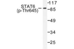 Image no. 1 for anti-Signal Transducer and Activator of Transcription 6, Interleukin-4 Induced (STAT6) (pThr645) antibody (ABIN318132) (STAT6 antibody  (pThr645))