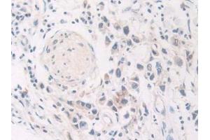 Immunohistochemistry (IHC) image for anti-Galactosidase, alpha (GLA) (AA 81-429) antibody (ABIN7431278)
