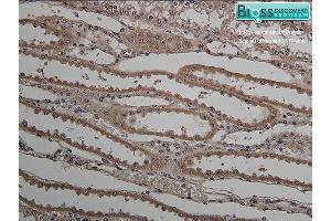 Immunohistochemistry (IHC) image for anti-Hydroxysteroid (11-Beta) Dehydrogenase 2 (HSD11B2) (AA 151-250) antibody (ABIN701680)