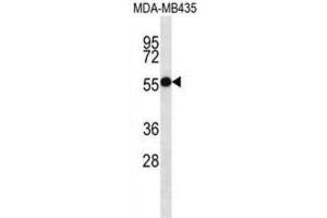 Western Blotting (WB) image for anti-Ankyrin Repeat and SOCS Box Containing 4 (ASB4) antibody (ABIN2997237) (ASB4 antibody)