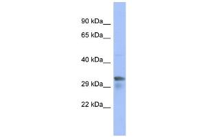 WB Suggested Anti-PIM1 Antibody Titration: 0.