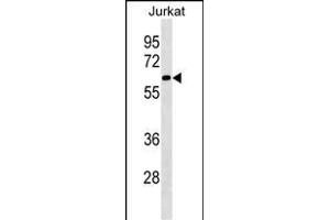 SLU7 Antibody (N-term) (ABIN1539489 and ABIN2849890) western blot analysis in Jurkat cell line lysates (35 μg/lane).