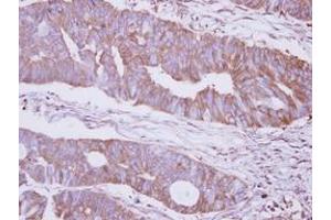 Image no. 1 for anti-Mannosidase, Alpha, Class 2B, Member 2 (MAN2B2) (N-Term) antibody (ABIN1494047) (MAN2B2 antibody  (N-Term))
