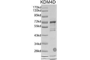 Recombinant JMJD2D / KDM4D protein gel. (JMJD2D Protein (DYKDDDDK Tag))