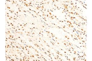 Immunohistochemistry (IHC) image for anti-Forkhead Box O3 (FOXO3) (pSer253) antibody (ABIN6255131)
