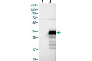 Western blot analysis of Lane 1: Negative control (vector only transfected HEK293T lysate), Lane 2: Over-expression Lysate (Co-expressed with a C-terminal myc-DDK tag (~3. (ZCCHC24 antibody)