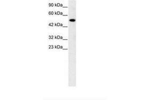 Image no. 3 for anti-Nuclear Receptor Subfamily 5, Group A, Member 1 (NR5A1) (AA 172-221) antibody (ABIN6735774) (NR5A1 antibody  (AA 172-221))
