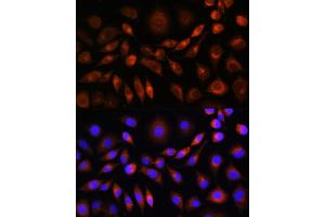 Immunofluorescence analysis of L929 cells using ApoM Rabbit pAb (ABIN6127365, ABIN6137030, ABIN6137031 and ABIN6220968) at dilution of 1:100. (Apolipoprotein M antibody  (AA 23-188))