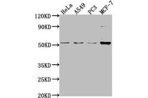 Western Blot Positive WB detected in: Hela whole cell lysate, A549 whole cell lysate, PC-3 whole cell lysate, MCF-7 whole cell lysate All lanes: FKTN antibody at 1:2000 Secondary Goat polyclonal to rabbit IgG at 1/50000 dilution Predicted band size: 54, 50 kDa Observed band size: 54 kDa (Fukutin antibody  (AA 87-276))