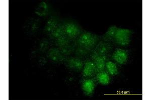 Immunofluorescence of monoclonal antibody to S100A7 on A-431 cell.