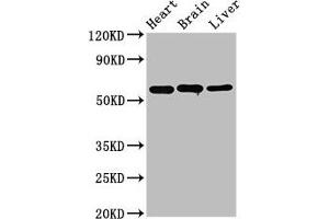 Western Blot Positive WB detected in: Rat heart tissue, Rat brain tissue, Mouse liver tissue All lanes: ALDH5A1 antibody at 3. (ALDH5A1 antibody  (AA 48-535))