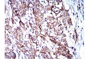 Immunohistochemistry (IHC) image for anti-BCL2/adenovirus E1B 19kDa Interacting Protein 3 (BNIP3) (AA 50-155) antibody (ABIN5858883) (BNIP3 antibody  (AA 50-155))