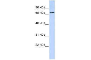 WB Suggested Anti-TRIM41 Antibody Titration:  0. (TRIM41 antibody  (C-Term))