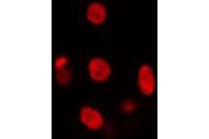 Immunofluorescence (fixed cells) (IF/ICC) image for anti-SWI/SNF Related, Matrix Associated, Actin Dependent Regulator of Chromatin, Subfamily C, Member 2 (SMARCC2) (Internal Region) antibody (ABIN6256999)