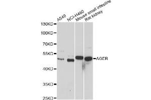 Western blot analysis of extracts of various cell lines, using AGER antibody. (RAGE antibody)