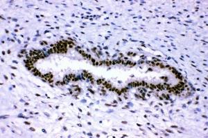 IHC analysis of p95 NBS1 using anti-p95 NBS1 antibody (ABIN3043282).