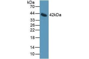 Western blot analysis of Mouse Serum. (IL11RA antibody  (AA 194-329))