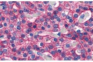 Anti-CASR antibody  ABIN1048374 IHC staining of human parathyroid.