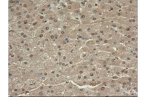 Image no. 13 for anti-Myc Proto-Oncogene protein (MYC) antibody (ABIN1497011) (c-MYC antibody)