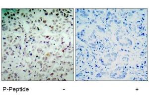 Image no. 1 for anti-Retinoblastoma 1 (RB1) (pSer780) antibody (ABIN196843) (Retinoblastoma 1 antibody  (pSer780))