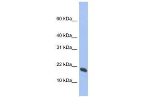 GMF gamma antibody used at 1 ug/ml to detect target protein.