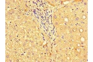 Immunohistochemistry of paraffin-embedded human liver tissue using ABIN7160576 at dilution of 1:100 (MYH3 antibody  (AA 1-217))